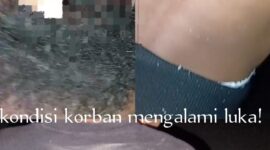 Kondisi korban usai diduga mengalami kekerasan saat operasi Satgas di wilayah perbatasan, tampak mengalami luka dan benjolan di sejumlah bagian tubuh.(Foto: Istimewa)
