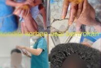 Kondisi korban usai insiden bentrokan saat upaya penyelesaian sengketa adat di Manlea, Minggu (22/2/2026). Foto:Doc.Istimewa
‎