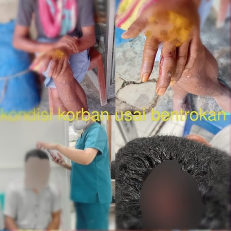 Kondisi korban usai insiden bentrokan saat upaya penyelesaian sengketa adat di Manlea, Minggu (22/2/2026). Foto:Doc.Istimewa
‎
